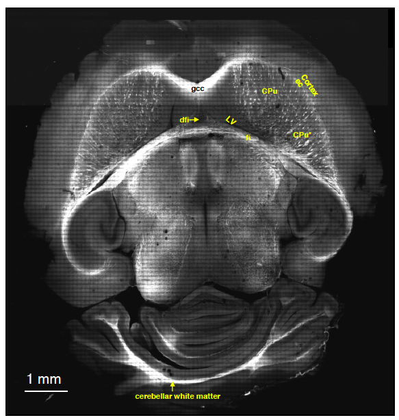 CARS image of a brain slice. The figure is a reprint from [1].